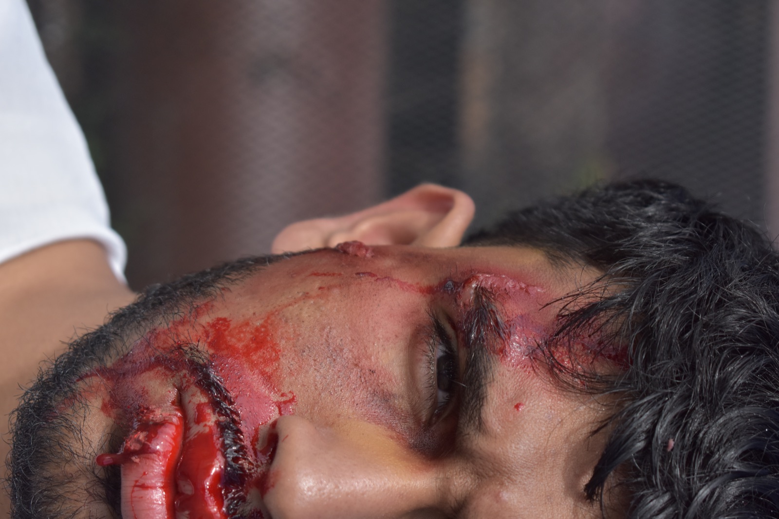 Close-up of half of Sree's face in bloodied fight makeup